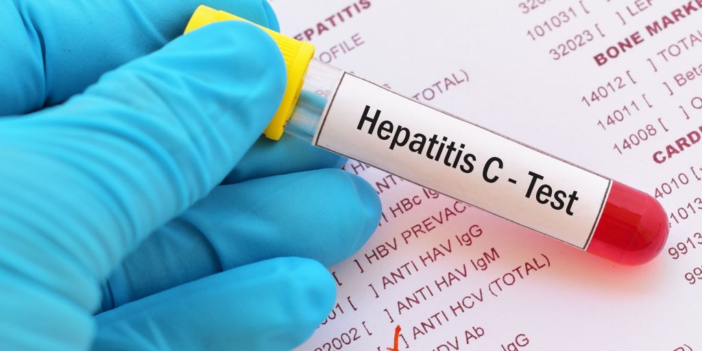 آزمایش هپاتیت B (HBV) در تهران